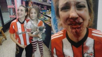 una hincha de river fue salvajemente atacada por un fanatico de boca una hincha de river fue salvajemente atacada por un fanatico de boca