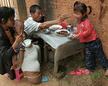 El pedido desesperado de la mujer con pata de elefante
