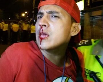 La oposición agredió a un fotógrafo en Ecuador - Crédito: eltelegrafo.com.ec