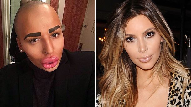 Hombre gastó 150 mil dólares para parecerse a Kim Kardashian y quedó así