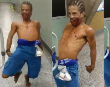 Un hombre que parecía poseído aterrorizó a los pacientes