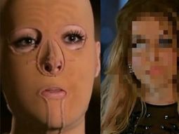 La increíble transformación de la mujer a la que le quemaron 60% del cuerpo