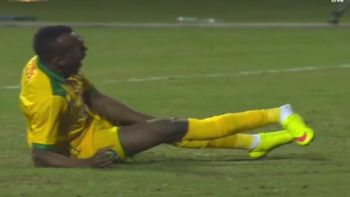 mira esta impresionante fractura expuesta mira esta impresionante fractura expuesta