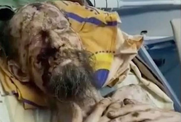 Alexander P. ya fue dado de alta