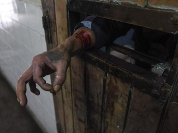 La Procuraduría de Violencia Institucional recorrió Olmos en junio y vio esta imagen de un preso autolesionado para pedir ayuda. (Foto: El Día)