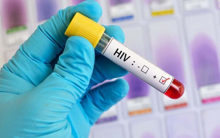 Por primera vez en 10 años, una vacuna contra el VIH llega a la última fase de ensayos