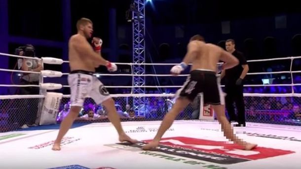 VIDEO: Escalofriante fractura de un luchador en artes marciales mixtas