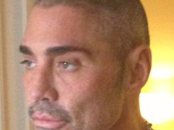 ricardo fort volvera a pasar por el quirofano ricardo fort volvera a pasar por el quirofano