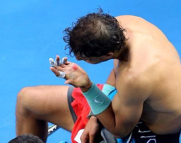 Mirá las fotos de la zurda de Rafael Nadal en carne viva