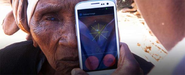 Crean un accesorio para smartphones que diagnostica enfermedades oculares