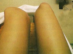 Rodilla.jpg Rodilla.jpg