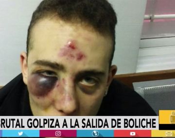 Brutal golpiza a la salida de boliche: le pegaron en el piso y quedó así