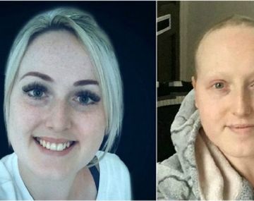 Sarah Boyle antes y después del tratamiento que no debía recibir