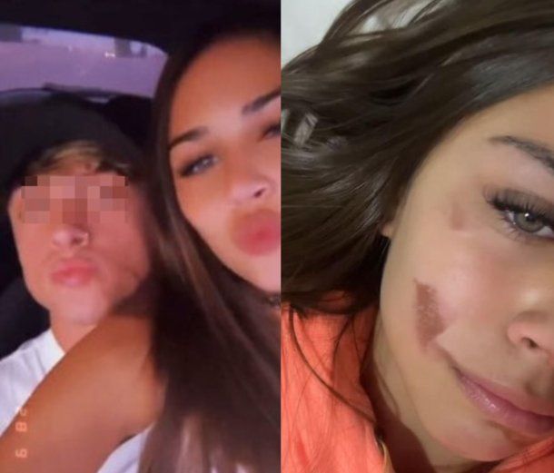 El video del joven que atropelló y mató a una mujer y su hija en Rosario, manejando con una influencer a upa