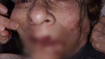 indignacion en mar del plata: un enfermero fue filmado mientras golpeaba a una anciana en un geriatrico indignacion en mar del plata: un enfermero fue filmado mientras golpeaba a una anciana en un geriatrico