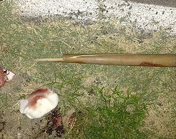 Un joven dejó con muerte cerebral a su tío tras golpearlo con un bate de béisbol