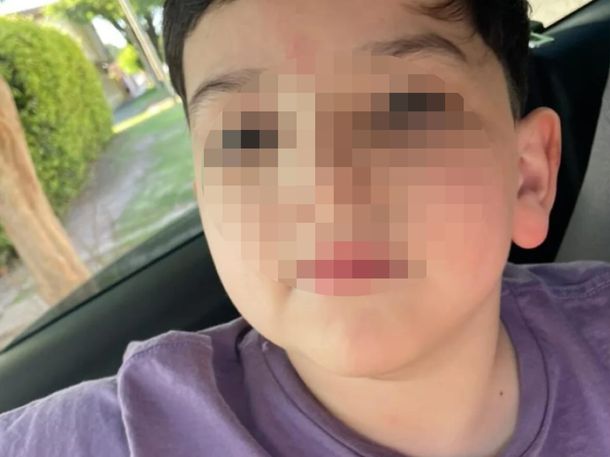 Parte médico: confirman que Bastian tiene lesiones cerebrales y cervicales severas