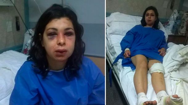 Una mujer caminó más de tres horas inconsciente luego de una paliza de su pareja