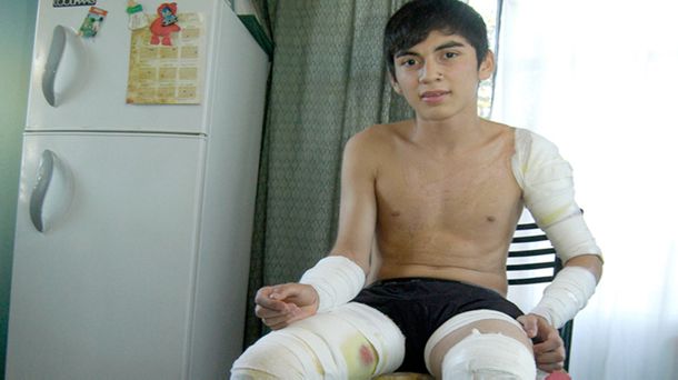 Se salvó de milagro tras haber sido atacado por violentos rottweilers