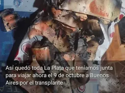 Se incendió la casa de su mamá y perdió el dinero para un trasplante