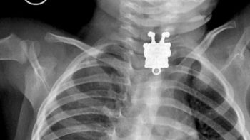 sobrevive luego de tragarse un bob esponja sobrevive luego de tragarse un bob esponja