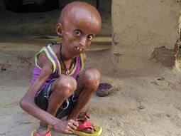 El drama del joven Rupesh