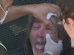 un jubilado fue ferozmente atacado con gas pimienta en medio de la marcha en congreso un jubilado fue ferozmente atacado con gas pimienta en medio de la marcha en congreso