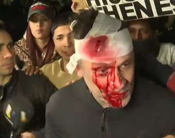 Incidentes en el acto de Milei en Moreno: le revolearon un botellazo a un periodista