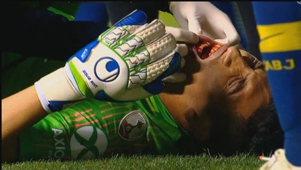 Esteban Andrada sufrió un fuerte golpe en su rostro