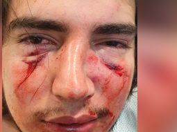 Feroz paliza de cuatro rugbiers a un joven de 18 años en Córdoba