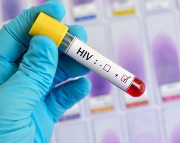 Dos de cada diez personas viven con VIH y no lo saben: cómo testearse en segundos