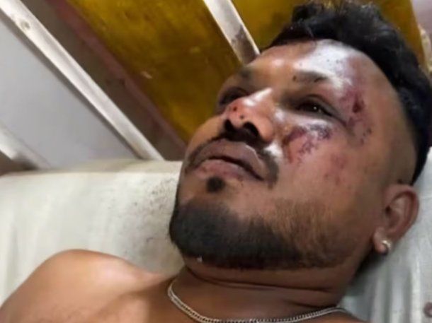 Milagro en la tragedia de Air India: encontraron a un sobreviviente