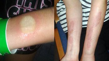 Una moda peligrosa Una moda peligrosa