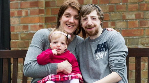 Sufre enfermedad genética y evitó el tratamiento para que su hija no la padeciera