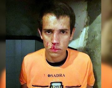 VIDEO: Un futbolista se enojó con el árbitro y le rompió la cara con un cabezazo