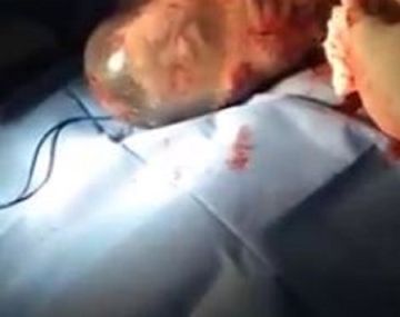 Mirá el bebé que bosteza dentro del saco amniótico