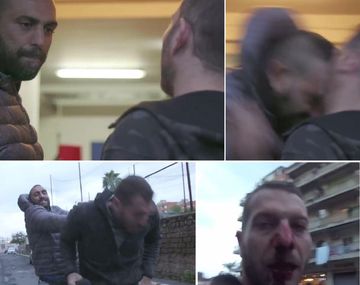 VIDEO: Matón de la mafia le rompió la nariz a un periodista de un cabezazo