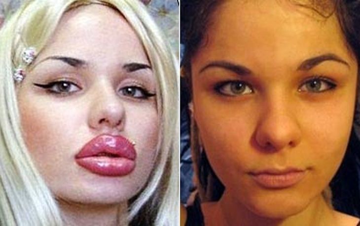 Antes-y-despúes