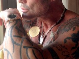 ricardo fort mostro como le quedo la rodilla tras la cirugia ricardo fort mostro como le quedo la rodilla tras la cirugia