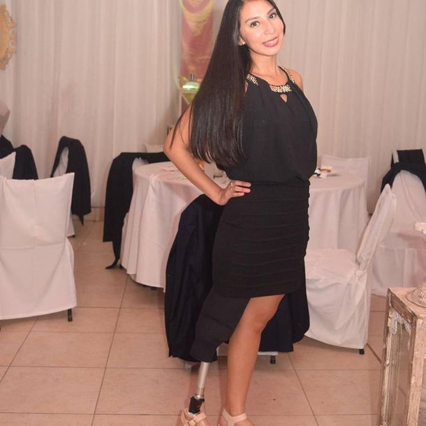 Fue a bailar y no la dejaron entrar al boliche porque le falta una pierna