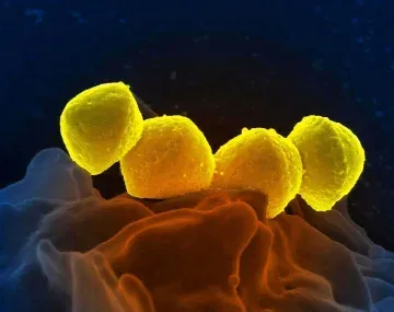 Streptococcus pyogenes: suben los casos y ya hay 93 muertos