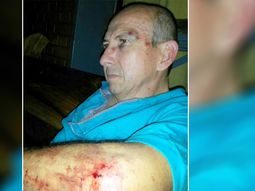 le toco bocina a un motociclista y recibio una brutal paliza le toco bocina a un motociclista y recibio una brutal paliza