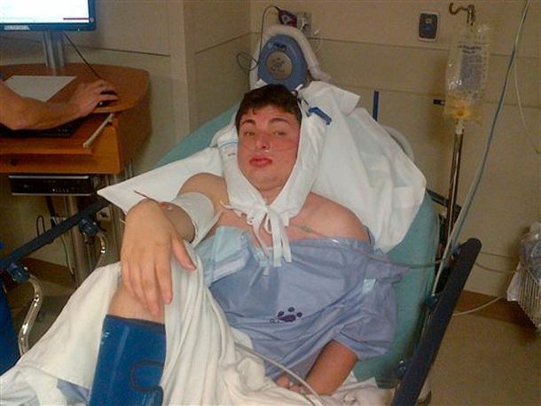 Neonazis golpean y le cosen la boca a un estudiante por ser judío