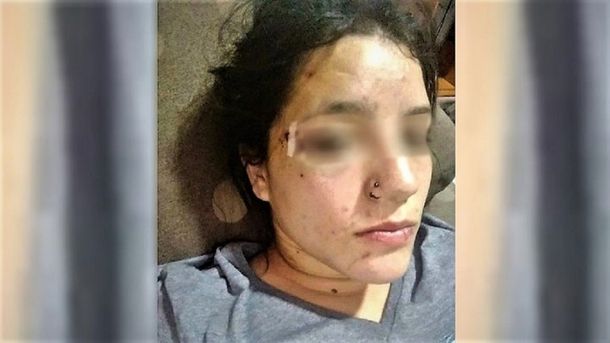 Fue a bailar en Año Nuevo y le dieron una brutal paliza