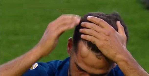 Emmanuel Mas exhibe el chichón tras el golpazo con Rafael Santos Borré