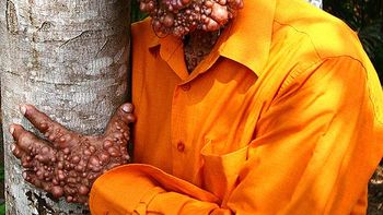 Chandra Wisnu, el hombre burbuja Chandra Wisnu, el hombre burbuja