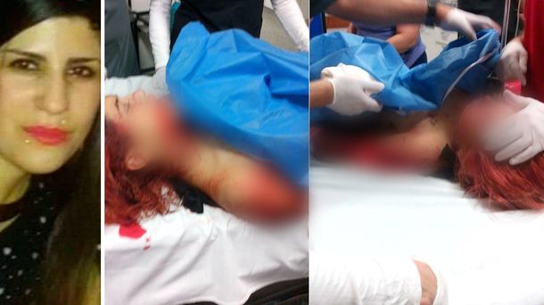 Se entregó la joven que atacó con un cúter a la actual pareja de su ex