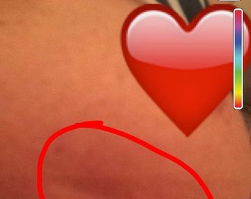 Miren sus lolas: la foto de una enferma de cáncer que podría salvar vidas