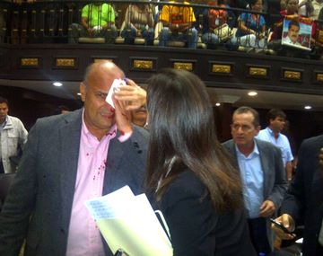 Sesión caliente en el congreso termina con un diputado herido