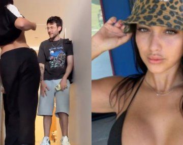 Flor Regidor mostró el resultado de su cirugía: Presentación de ellas